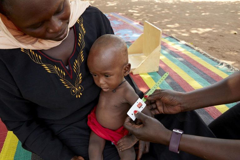 Amira, una bebé de 9 meses, llega a un centro de salud apoyado por UNICEF con un cuadro de desnutrición aguda grave.